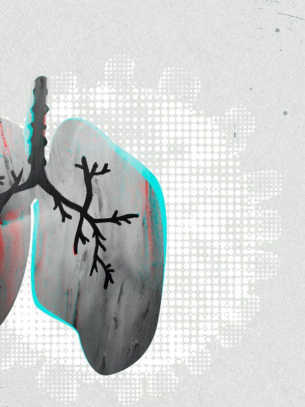 胸腔常見病症－肺炎及COPD
