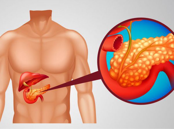 潛伏在腹腔中的癌王－認識胰臟癌的危險因子