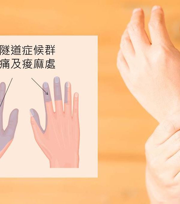 手指痠麻痛 都是腕隧道惹的禍？