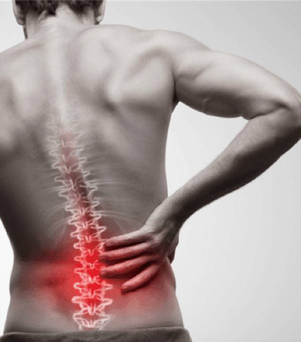 惱人的下背痛－腰椎間盤突出症