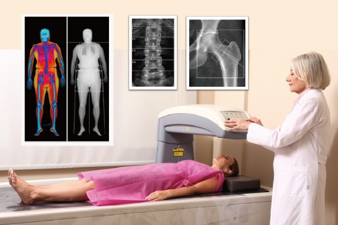 【公告】本院引進最新「DXA雙能量X光吸收儀」骨質疏鬆檢測服務