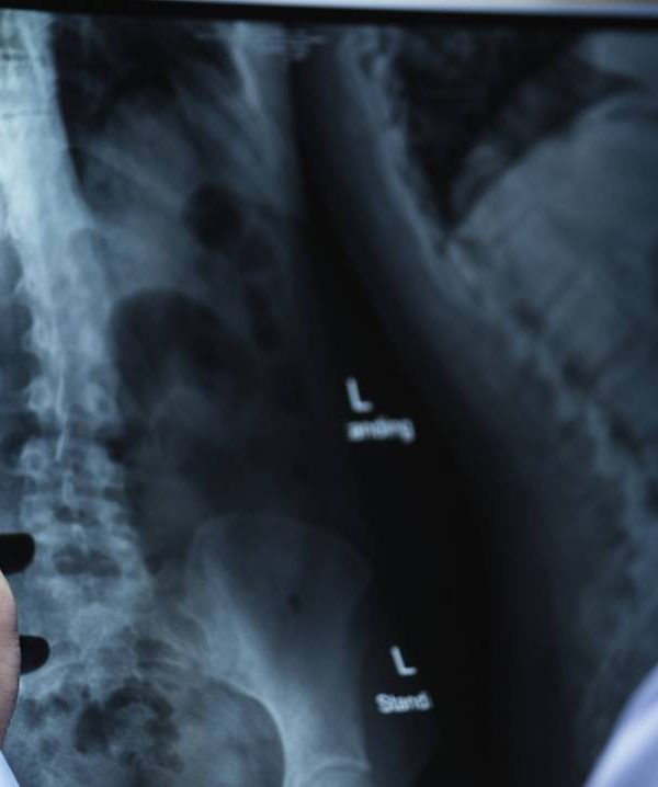 脊椎動刀，是一項高風險手術？