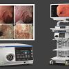 【公告】本院腸胃肝膽內科引進「奧林巴斯OLYMPUS—CV-1500影像處理系統」服務