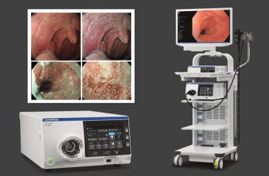 CV-1500系統,OLYMPUS最新世代EVIS X1系列