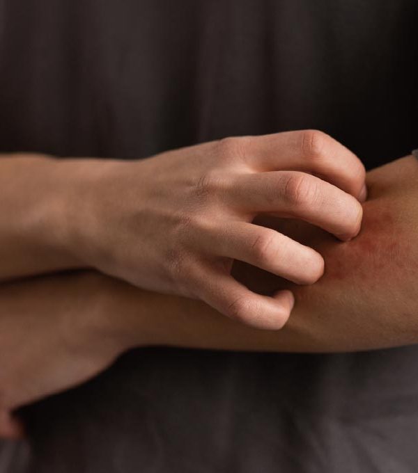 冬季皮膚乾癢的成因與防範措施